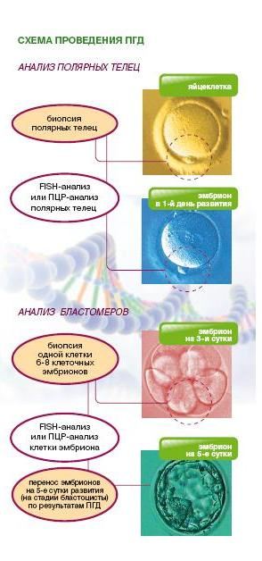 Преимплантационная диагностика эмбриона в клинике Преимплантационная диагностика эмбриона